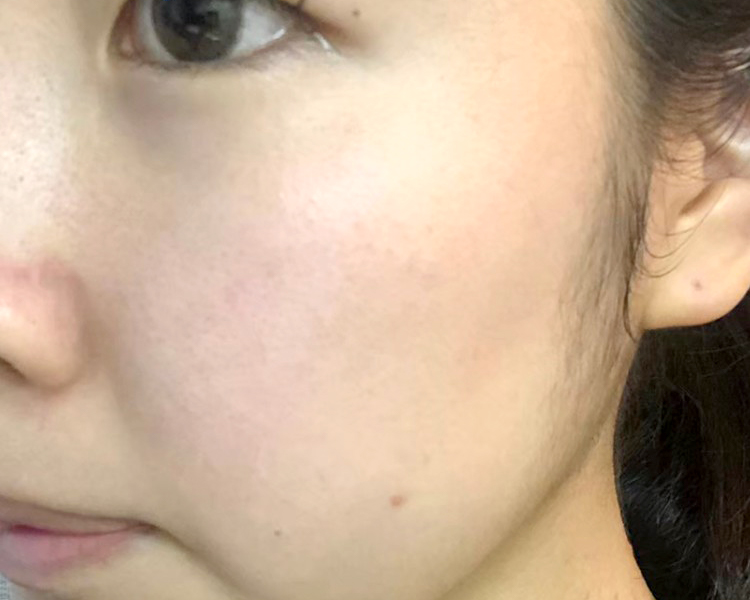 マトリックスエキス　お試し　navis 18日目②